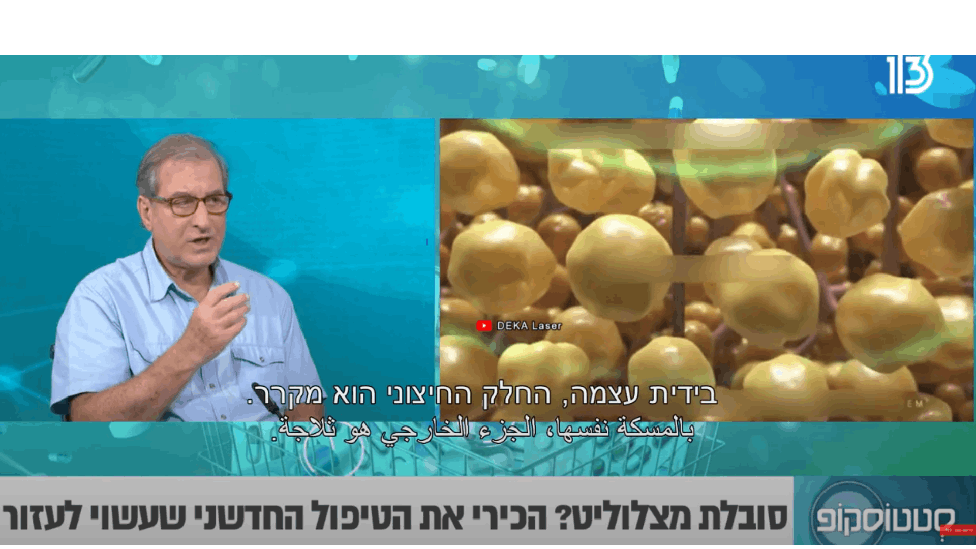 יאיר גילוני בערוץ 13