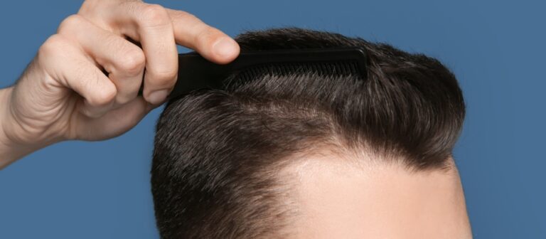 צפיפות שיער - קריטי לפני טיפול ריגנרה