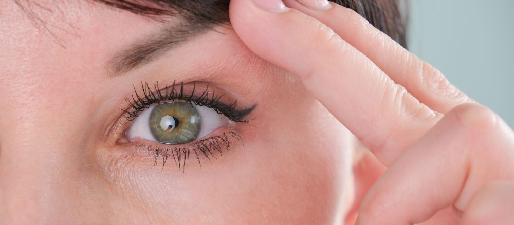 הרמת עפעפיים ללא צורך בניתוח